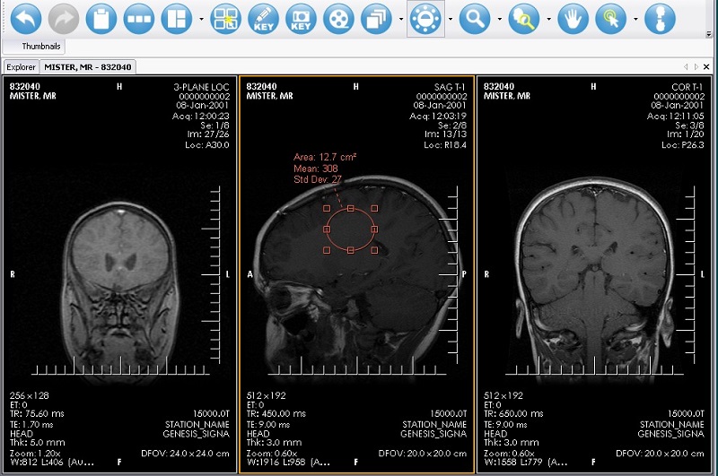 XRayline Workstation 64 bit Screenshot